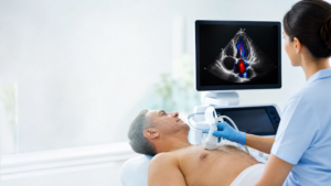 Échographie cardiaque Doppler : indications,déroulement et intérêt